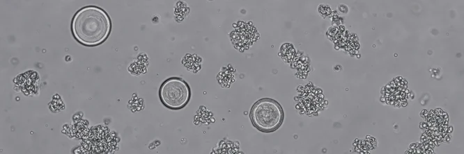 imagen de oxalato de calcio