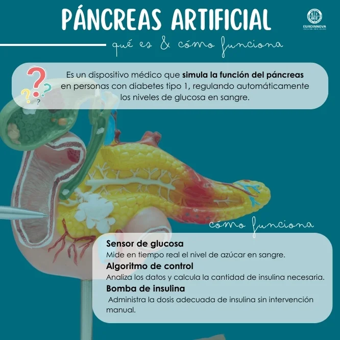Páncreas artificial: qué es y cuándo se utiliza