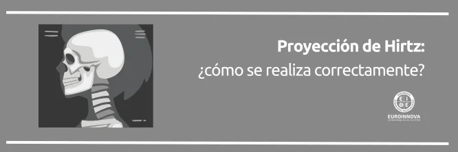 Descubre el método de la Proyección de Hirtz
